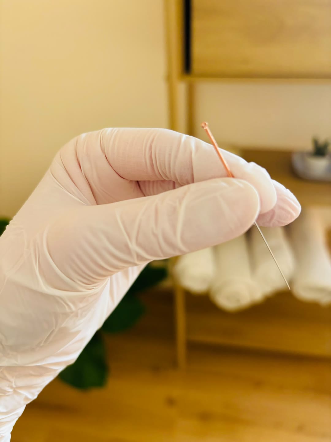 Vorbereitete Akupunkturnadel in einer behandschuhten Hand
